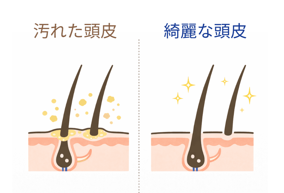 H-non療法前にシャンプーを行う理由