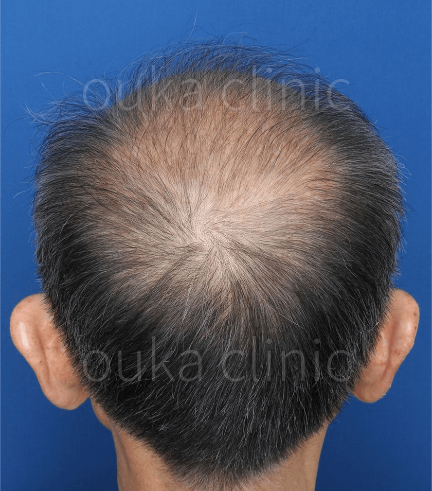 全体の治療後の画像