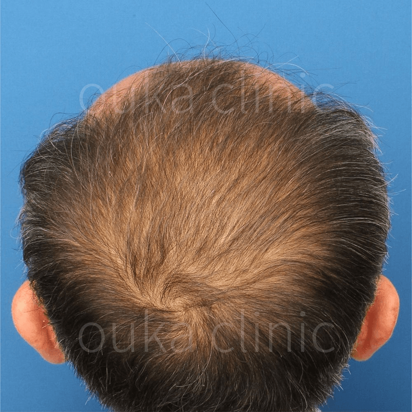 全体の治療後の画像