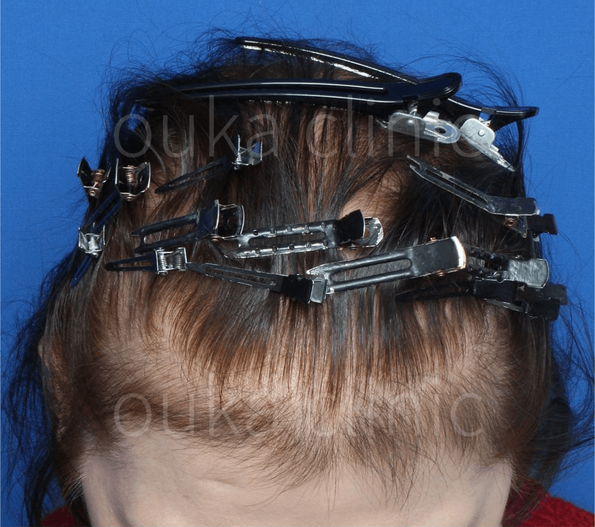 全体の治療後の画像