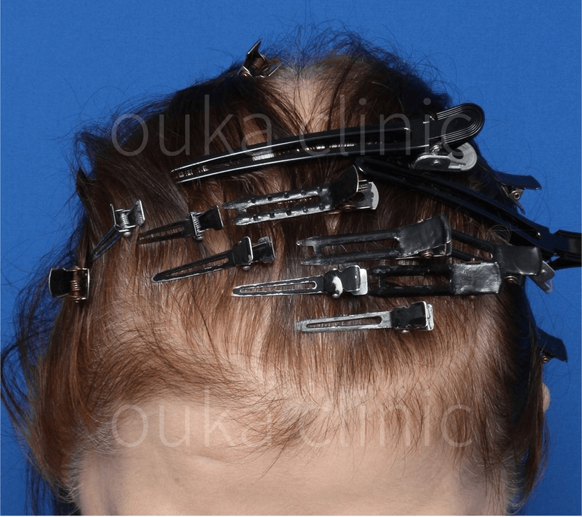 全体の治療前の画像