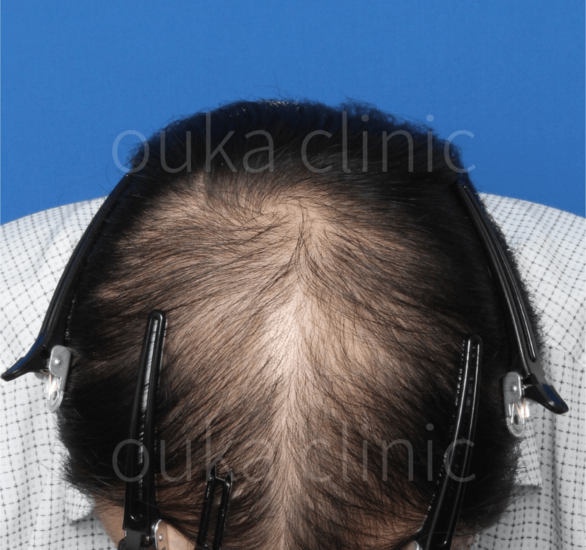 全体の治療前の画像