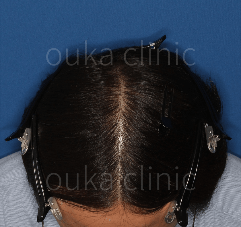 全体の治療後の画像