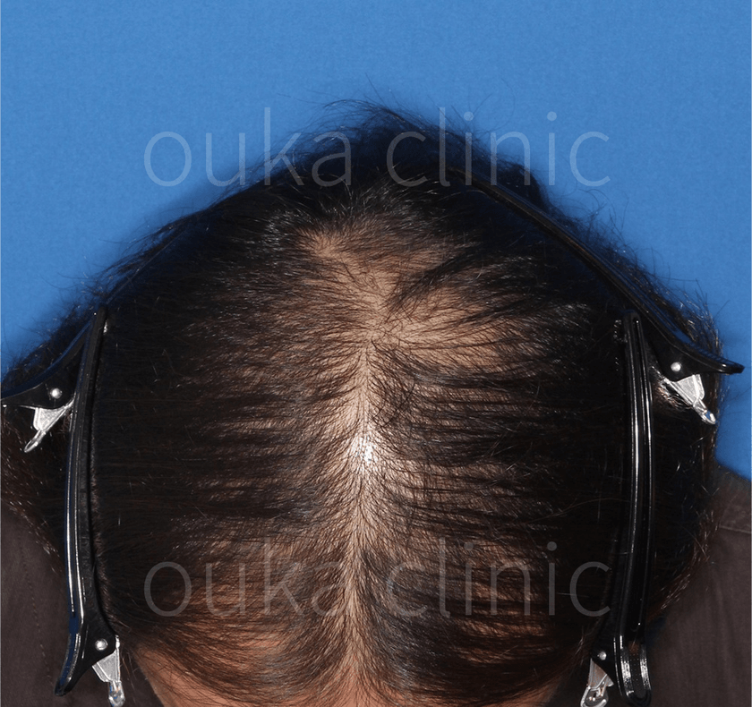 全体の治療前の画像