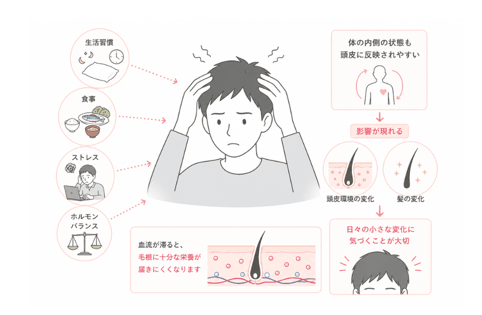 頭皮の状態に影響を与える生活習慣・食事・ストレス・ホルモンバランスを示したイラスト
