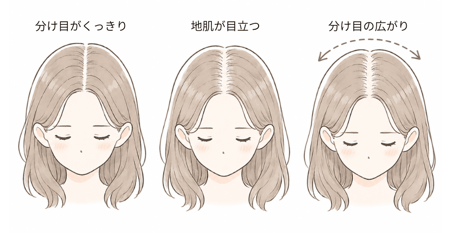 分け目がくっきり・地肌が目立つ・分け目の広がりという分け目の変化を比較したイラスト