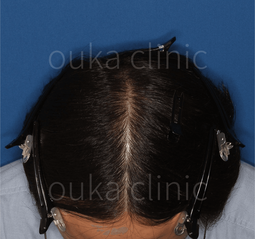 全体の治療後の画像