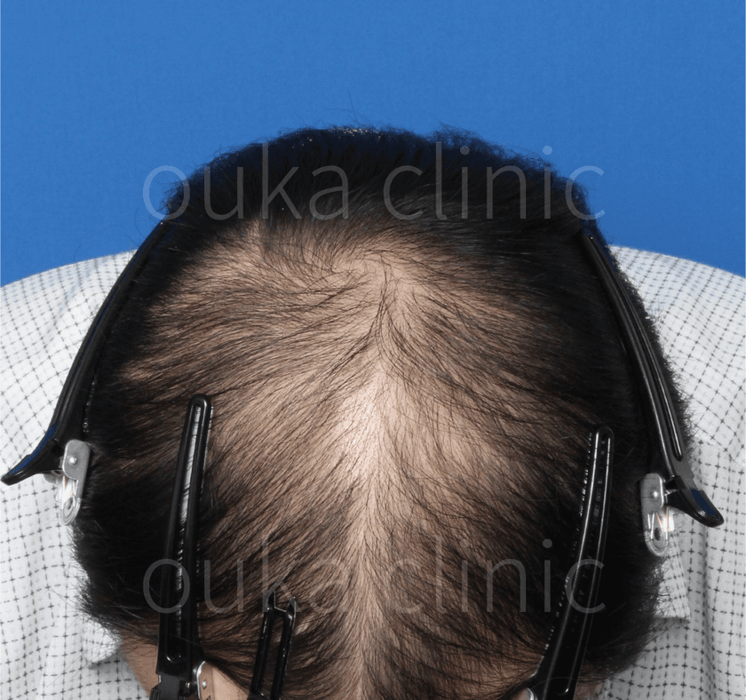 全体の治療前の画像