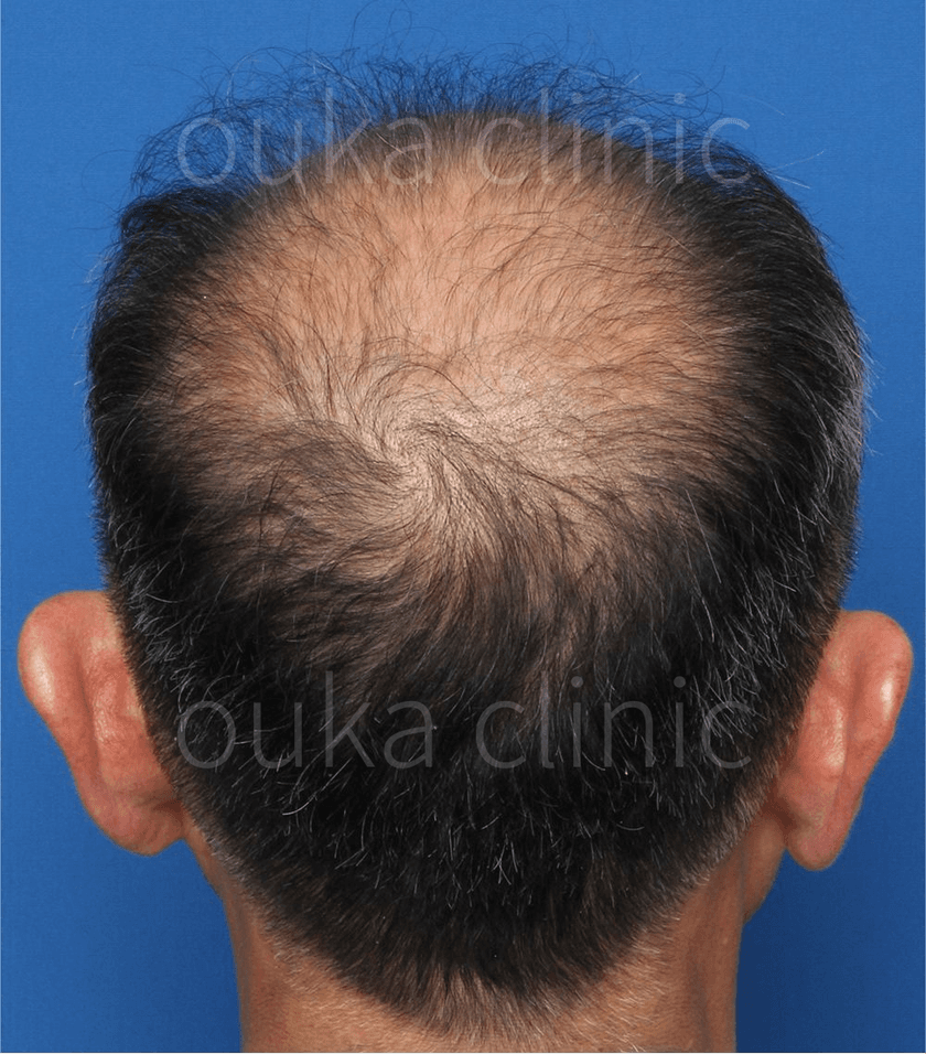 全体の治療前の画像