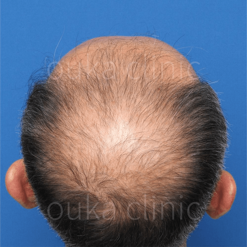 全体の治療前の画像