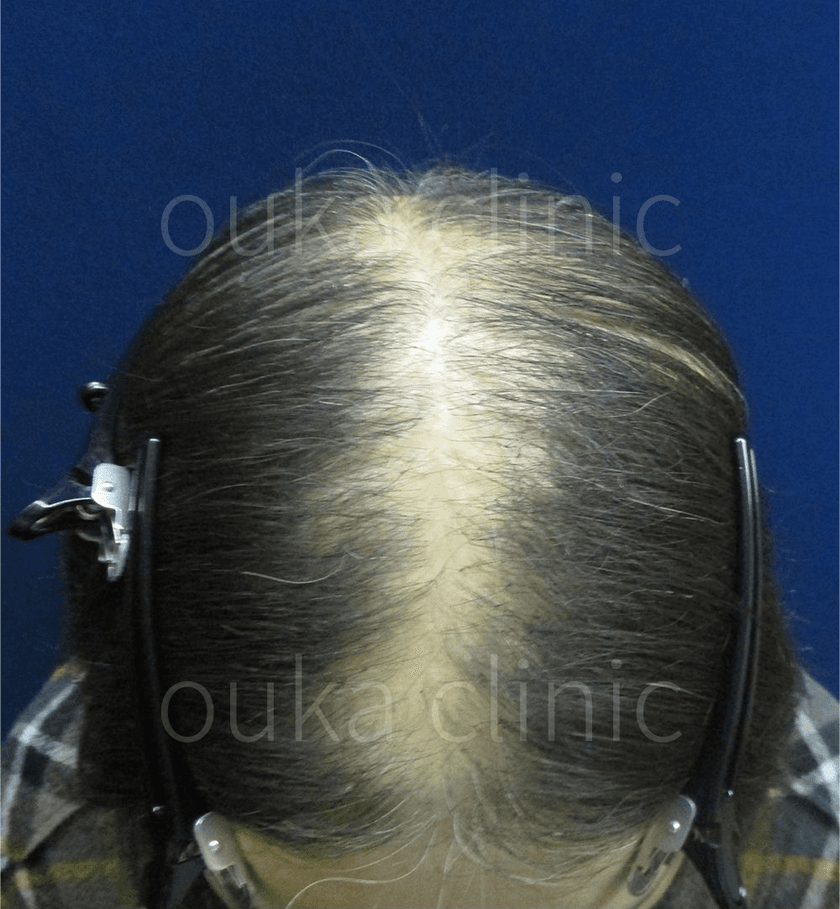 全体の治療前の画像