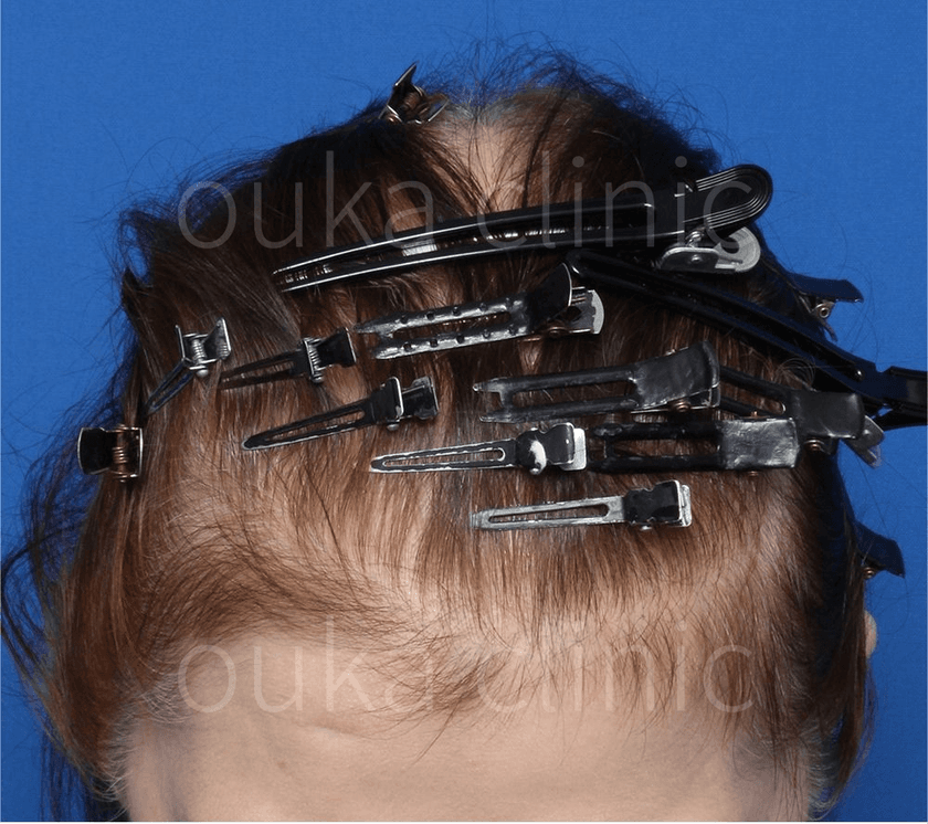 全体の治療前の画像