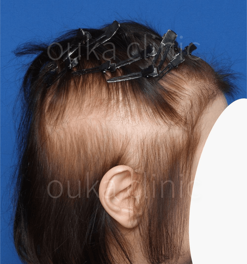 全体の治療後の画像